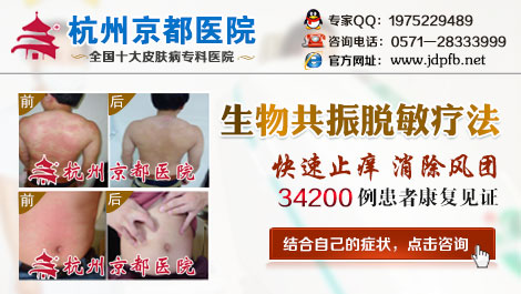 荨麻疹让人烦恼多,怎样快速治疗荨麻疹点击